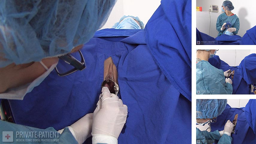 PP424_Small-Incision-04