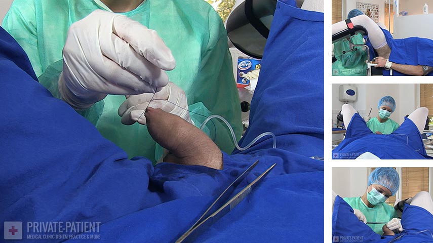 PP335_Ablatio-Testis-05