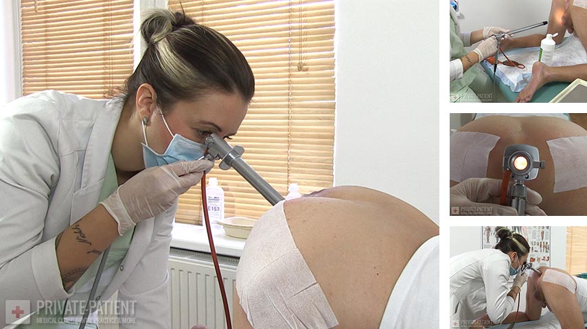 PP623_Rectoscopy-03