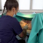 Rectal Biopsy 04