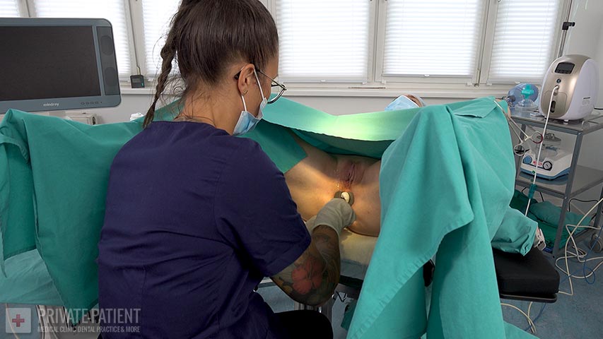 PP4384_Rectal-Biopsy-04